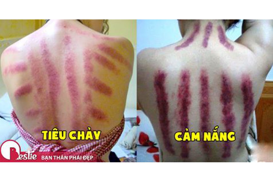 Kỹ sư nổi tiếng 36 tuổi bị đột tử và câu chuyện của anh có thể thức tỉnh tất cả mọi người