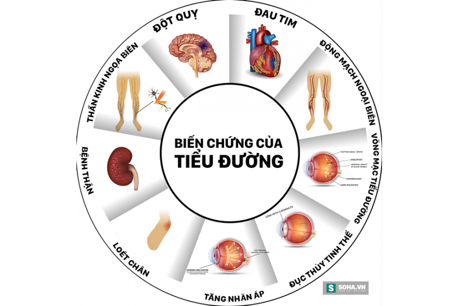 Chữa bệnh tiểu đường tận gốc