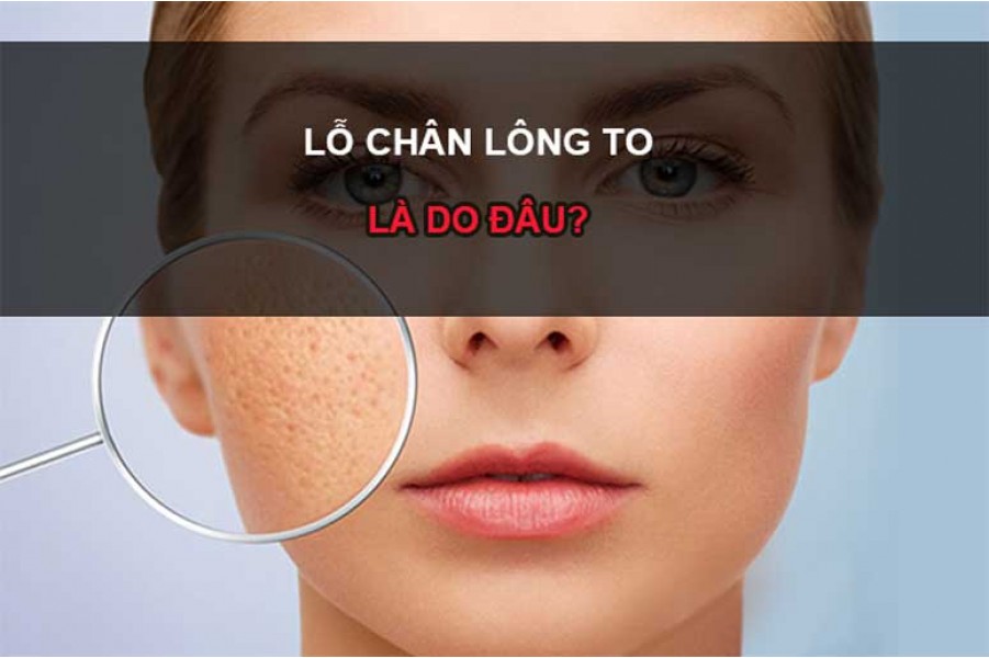 Giải đáp Tại sao lỗ chân lông to?