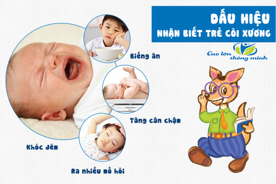 Trị bệnh còi xương 