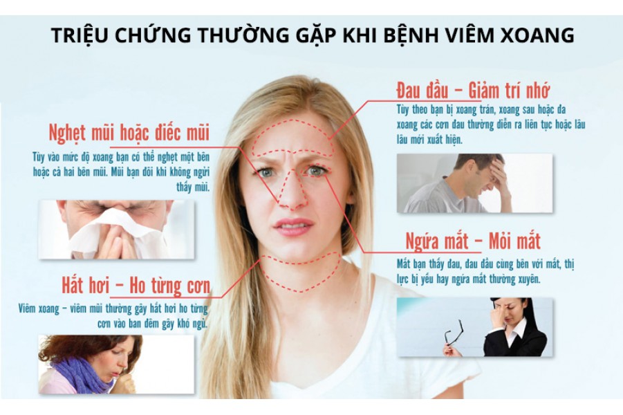 Trị bệnh viêm xoang viêm mũi dị ứng tận gốc